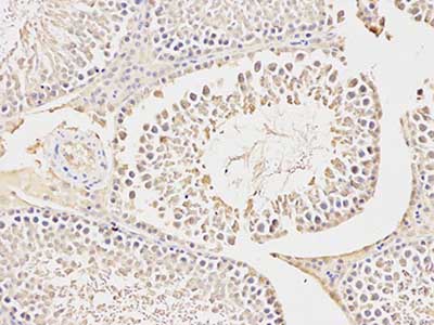 Immunohistochemistry (Formalin/PFA-fixed paraffin-embedded sections) - Anti-Carbonic Anhydrase 3/CA3 antibody (AB196835), expandable thumbnail