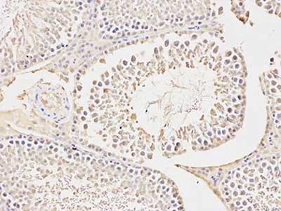 Immunohistochemistry (Formalin/PFA-fixed paraffin-embedded sections) - Anti-Carbonic Anhydrase 3/CA3 antibody (AB196835)