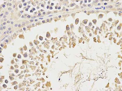 Immunohistochemistry (Formalin/PFA-fixed paraffin-embedded sections) - Anti-Carbonic Anhydrase 3/CA3 antibody (AB196835)