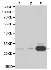 Western blot - Anti-Carbonic Anhydrase 3/CA3 antibody (AB196835)