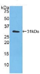 Western blot - Anti-Carbonic Anhydrase 3/CA3 antibody [C2] (AB239504), expandable thumbnail