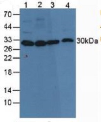 Western blot - Anti-Carbonic Anhydrase 3/CA3 antibody [C2] (AB239504), expandable thumbnail