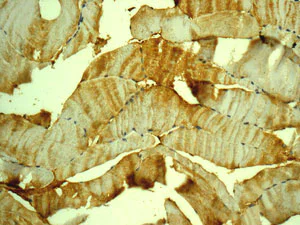 Immunohistochemistry (Formalin/PFA-fixed paraffin-embedded sections) - Anti-Carbonic Anhydrase 3/CA3 antibody [EPR13425] (AB181358)