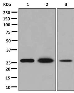 Western blot - Anti-Carbonic Anhydrase 3/CA3 antibody [EPR13425] - BSA and Azide free (AB250486)