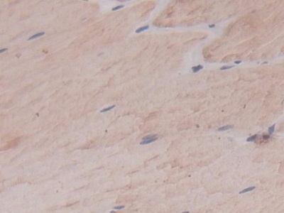 Immunohistochemistry (Formalin/PFA-fixed paraffin-embedded sections) - Anti-Carbonic Anhydrase 4/CA4 antibody [C1] (AB239505)