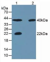 Western blot - Anti-Carbonic Anhydrase 4/CA4 antibody [C1] (AB239505)