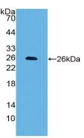 Western blot - Anti-Carbonic Anhydrase 4/CA4 antibody [C1] (AB239505)