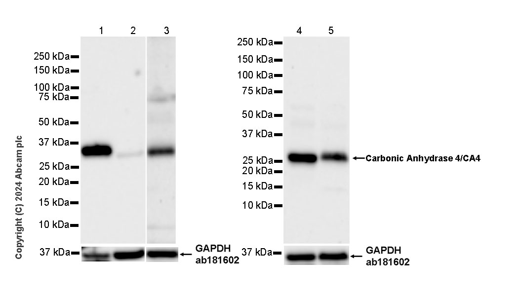 Western blot - Anti-Carbonic Anhydrase 4/CA4 antibody [EPR29192-88] (AB323257), expandable thumbnail