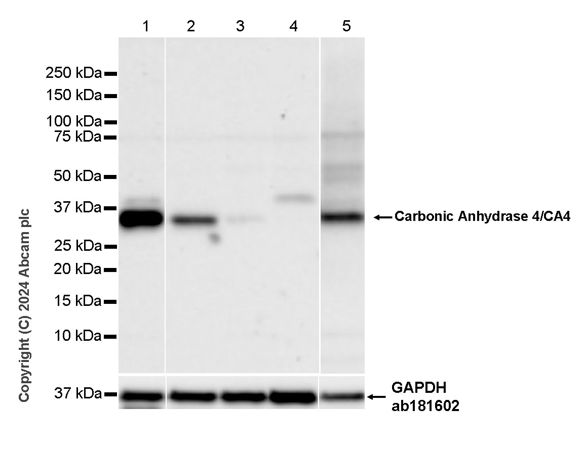 Western blot - Anti-Carbonic Anhydrase 4/CA4 antibody [EPR29192-88] (ab323257), expandable thumbnail