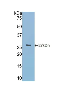 Western blot - Anti-Carbonic Anhydrase 5A/CA5A antibody (AB231676)