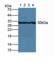 Western blot - Anti-Carbonic Anhydrase 5A/CA5A antibody (AB231676)
