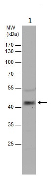 Western blot - Anti-Carbonic Anhydrase 5B/CA5B antibody (AB229006)
