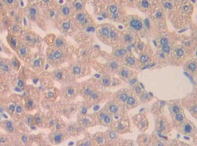 Immunohistochemistry (Formalin/PFA-fixed paraffin-embedded sections) - Anti-Carbonic Anhydrase 5B/CA5B antibody (AB231663), expandable thumbnail