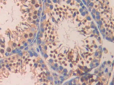 Immunohistochemistry (Formalin/PFA-fixed paraffin-embedded sections) - Anti-Carbonic Anhydrase 5B/CA5B antibody (AB231663), expandable thumbnail