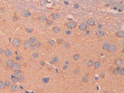 Immunohistochemistry (Formalin/PFA-fixed paraffin-embedded sections) - Anti-Carbonic Anhydrase 5B/CA5B antibody (AB231663), expandable thumbnail