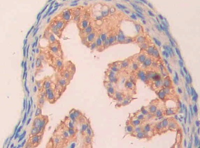 Immunohistochemistry (Formalin/PFA-fixed paraffin-embedded sections) - Anti-Carbonic Anhydrase 5B/CA5B antibody (AB231663), expandable thumbnail