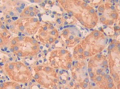 Immunohistochemistry (Formalin/PFA-fixed paraffin-embedded sections) - Anti-Carbonic Anhydrase 5B/CA5B antibody (ab231663), expandable thumbnail