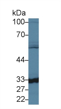 Western blot - Anti-Carbonic Anhydrase 5B/CA5B antibody (ab231663), expandable thumbnail