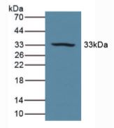 Western blot - Anti-Carbonic Anhydrase 5B/CA5B antibody (ab231663), expandable thumbnail