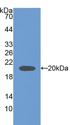 Western blot - Anti-Carbonic Anhydrase 5B/CA5B antibody (ab231663), expandable thumbnail
