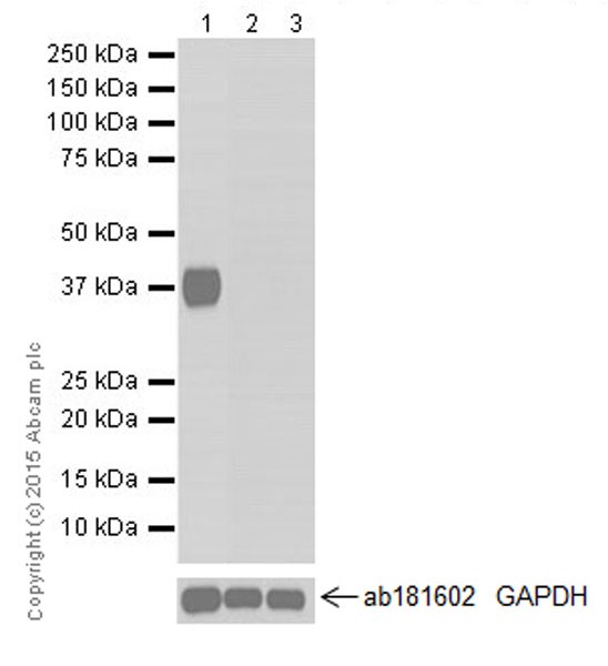 Western blot - Anti-Carbonic Anhydrase 6/CA6 antibody [EPR13954(2)] - BSA and Azide free (AB251516), expandable thumbnail