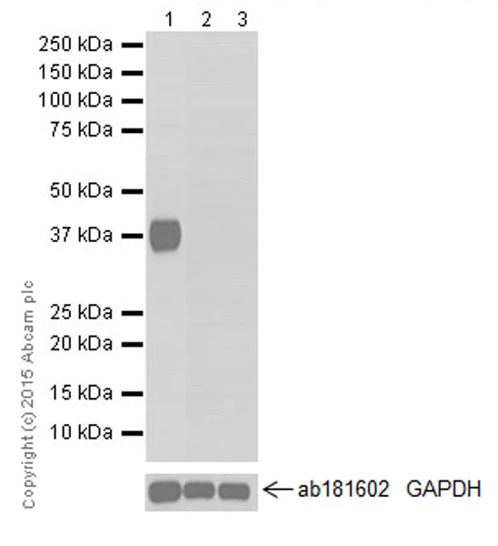 Western blot - Anti-Carbonic Anhydrase 6/CA6 antibody [EPR13954(2)] - BSA and Azide free (AB251516)