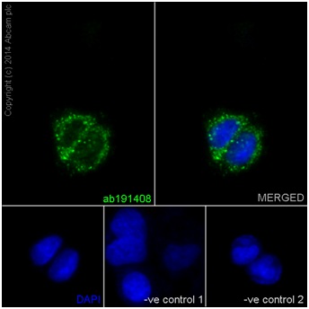 Immunocytochemistry/ Immunofluorescence - Anti-Carbonic Anhydrase 7/CA7 antibody [EPR13304] (AB191408)