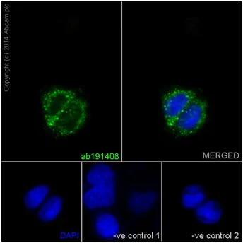 Immunocytochemistry/ Immunofluorescence - Anti-Carbonic Anhydrase 7/CA7 antibody [EPR13304] (AB191408)
