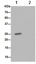 Immunoprecipitation - Anti-Carbonic Anhydrase 7/CA7 antibody [EPR13304] (AB191408)