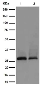 Western blot - Anti-Carbonic Anhydrase 7/CA7 antibody [EPR13304] (AB191408)