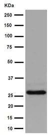 Western blot - Anti-Carbonic Anhydrase 7/CA7 antibody [EPR13304] (AB191408)