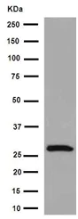 Western blot - Anti-Carbonic Anhydrase 7/CA7 antibody [EPR13304] (AB191408)