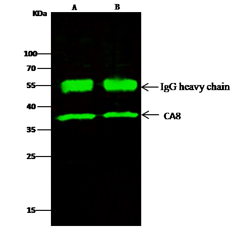 Immunoprecipitation - Anti-Carbonic Anhydrase 8/CA8 antibody [005] (AB275656), expandable thumbnail
