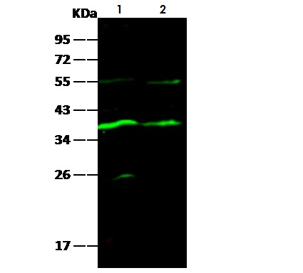 Western blot - Anti-Carbonic Anhydrase 8/CA8 antibody [005] (AB275656), expandable thumbnail