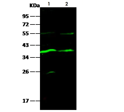 Western blot - Anti-Carbonic Anhydrase 8/CA8 antibody [005] (AB275656)
