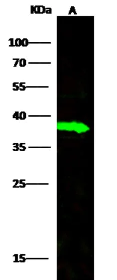 Western blot - Anti-Carbonic Anhydrase 8/CA8 antibody [008] - BSA and Azide free (AB276039)