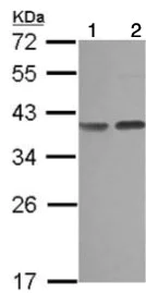 Western blot - Anti-Carbonic Anhydrase 8/CA8 antibody (AB126070)
