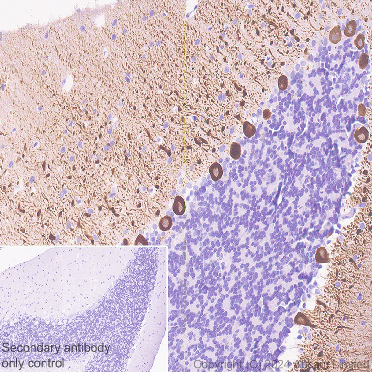 Immunohistochemistry (Formalin/PFA-fixed paraffin-embedded sections) - Anti-Carbonic Anhydrase 8/CA8 antibody [EPR29175-67] (AB319156)
