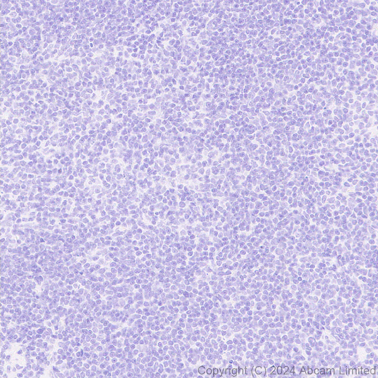 Immunohistochemistry (Formalin/PFA-fixed paraffin-embedded sections) - Anti-Carbonic Anhydrase 8/CA8 antibody [EPR29175-67] (AB319156)