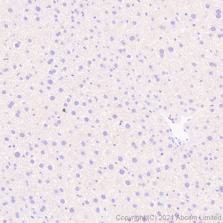 Immunohistochemistry (Formalin/PFA-fixed paraffin-embedded sections) - Anti-Carbonic Anhydrase 8/CA8 antibody [EPR29175-67] (AB319156)
