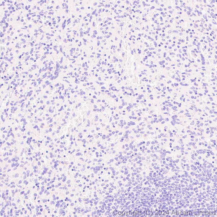 Immunohistochemistry (Formalin/PFA-fixed paraffin-embedded sections) - Anti-Carbonic Anhydrase 8/CA8 antibody [EPR29175-67] (AB319156)