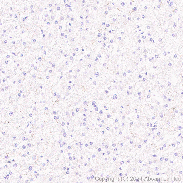 Immunohistochemistry (Formalin/PFA-fixed paraffin-embedded sections) - Anti-Carbonic Anhydrase 8/CA8 antibody [EPR29175-67] (AB319156)