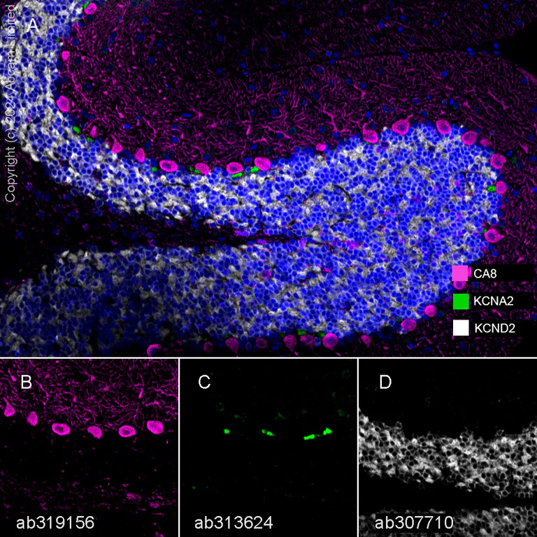 Multiplex immunohistochemistry - Anti-Carbonic Anhydrase 8/CA8 antibody [EPR29175-67] (AB319156)