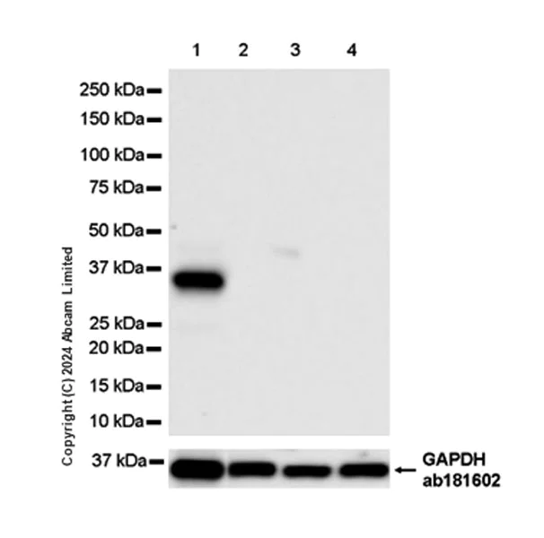 Western blot - Anti-Carbonic Anhydrase 8/CA8 antibody [EPR29175-67] (AB319156)