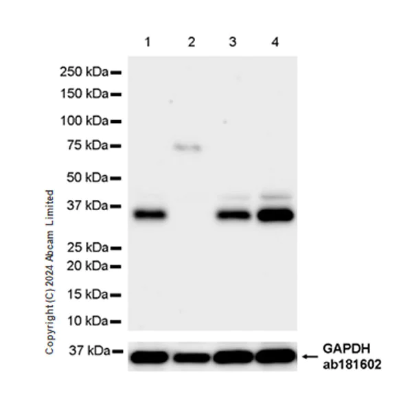 Western blot - Anti-Carbonic Anhydrase 8/CA8 antibody [EPR29175-67] (AB319156)