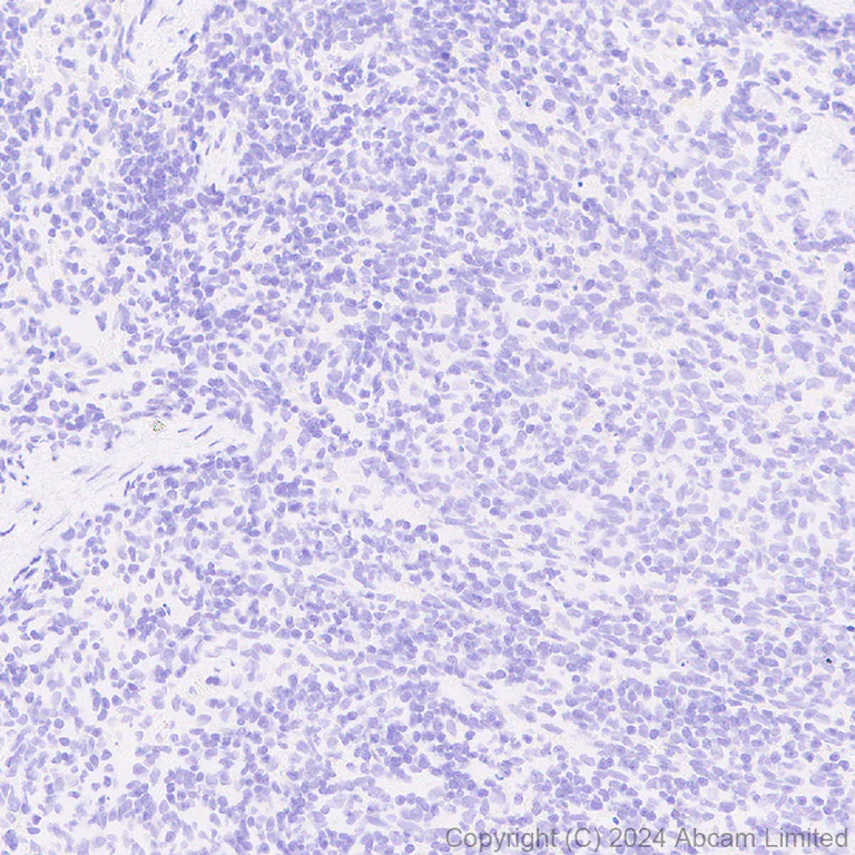 Immunohistochemistry (Formalin/PFA-fixed paraffin-embedded sections) - Anti-Carbonic Anhydrase 8/CA8 antibody [EPR29175-67] - BSA and Azide free (AB319157)