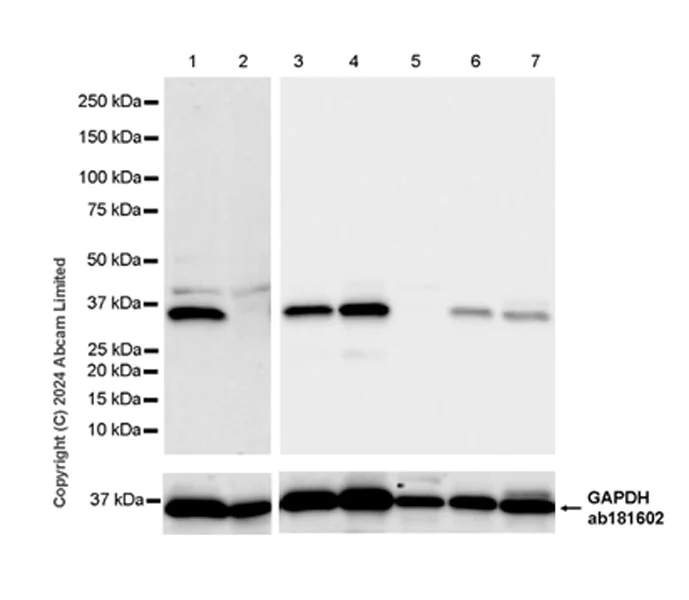 Western blot - Anti-Carbonic Anhydrase 8/CA8 antibody [EPR29175-67] - BSA and Azide free (AB319157)