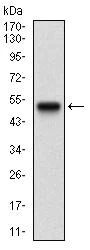 Western blot - Anti-Carbonic Anhydrase 9/CA9 antibody [10F7A8] - N-terminal (AB181464)