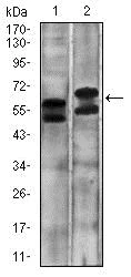 Western blot - Anti-Carbonic Anhydrase 9/CA9 antibody [10F7A8] - N-terminal (AB181464)
