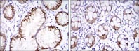 Immunohistochemistry (Formalin/PFA-fixed paraffin-embedded sections) - Anti-Carbonic Anhydrase 9/CA9 antibody [2D3] (AB107257)